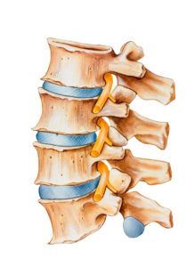 Lumbar Disc Herniation - Atlanta Brain and Spine Care