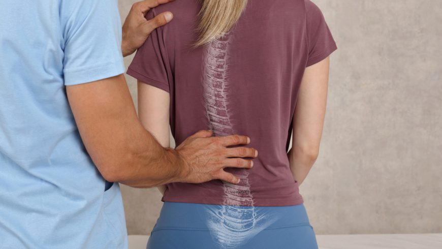 Four Common Types of Scoliosis